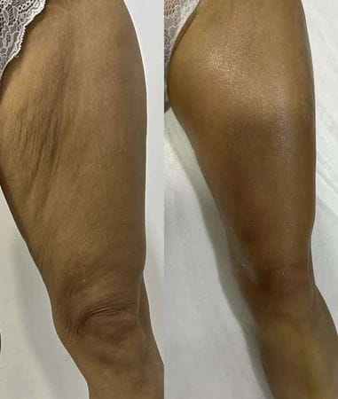 Corpo, Anticellulite & Rimodellamento 2