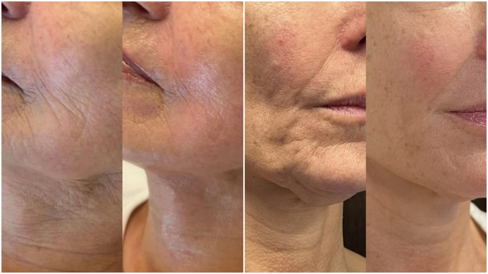 Trattamento Beauty Balance 14