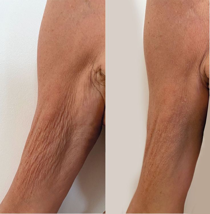 Corpo, Anticellulite & Rimodellamento 1