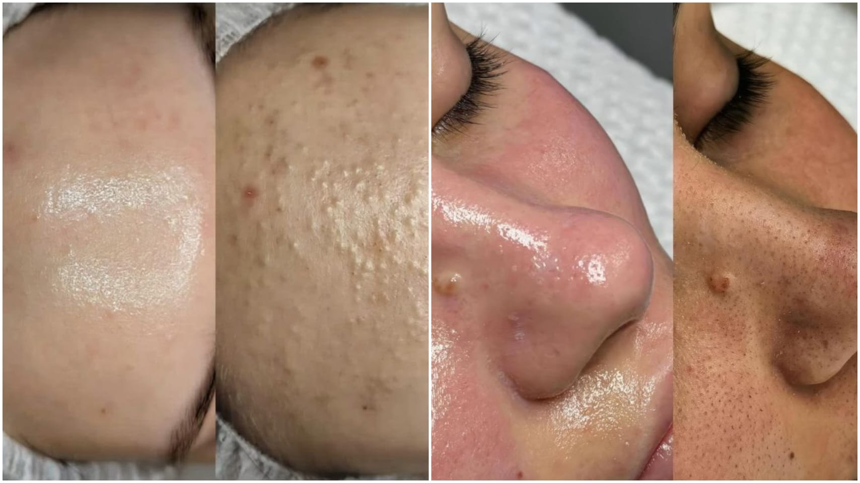 Trattamento Beauty Balance 16