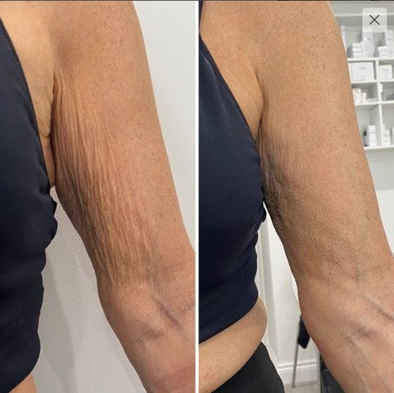 Corpo, Anticellulite & Rimodellamento 5