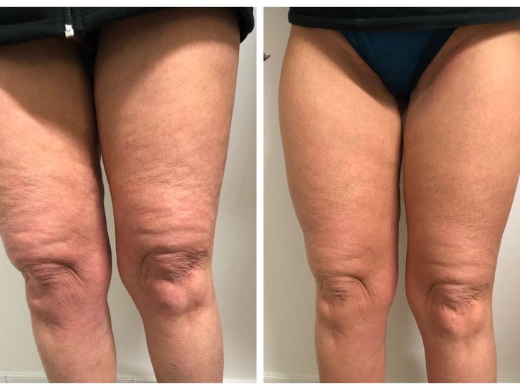 Corpo, Anticellulite & Rimodellamento 3
